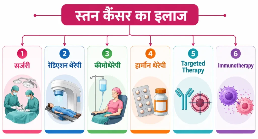 स्तन कैंसर (Breast Cancer) के इलाज के प्रमुख विकल्पों का फ्लोचार्ट, जिसमें सर्जरी, रेडिएशन थेरेपी, कीमोथेरेपी, हार्मोन थेरेपी, टार्गेटेड थेरेपी और इम्यूनोथेरेपी दिखाई गई है।